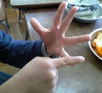 �e�l�`���b�s�[ �c�i����