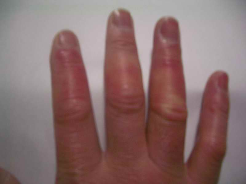 �C�܂�����L