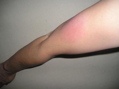 ���ƒ�̉ԂƎČ��E��